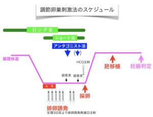 調節卵巣刺激法