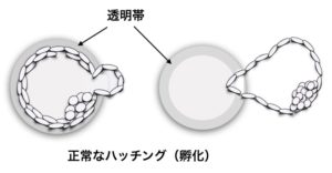 ハッチング