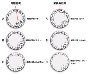 gardner分類