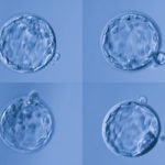 blastocyst