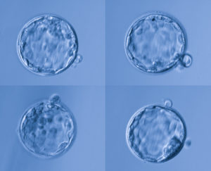 blastocyst