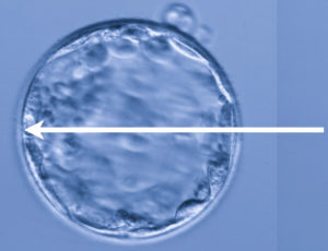 胚盤胞分割
